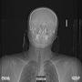Early Onset Rigor Mortis (Explicit)