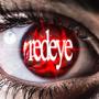 Redeye