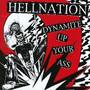 Dynamite Up Your A**