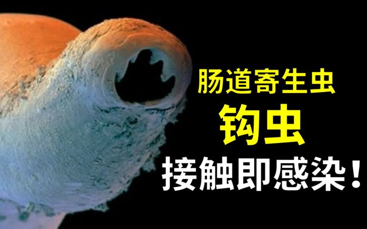 钩虫:你信不信我碰你一下你就没了?搞不好还让你以破布为食!