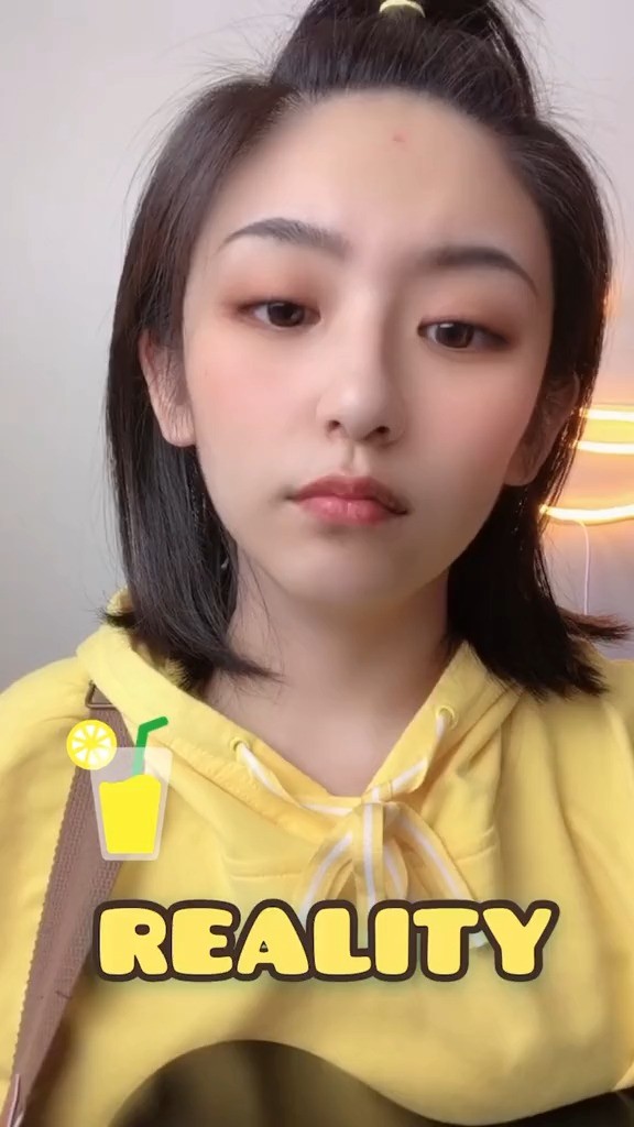 - #reality 脑门上了个包 有点忧伤